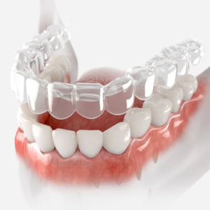 reatiners_0497146b-4575-4951-85d